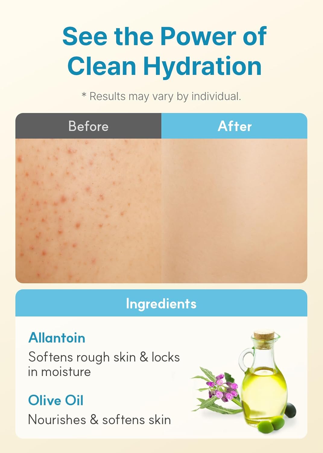 Derma: B Daily Moisture Body Lotion Jumbo [400ml]	